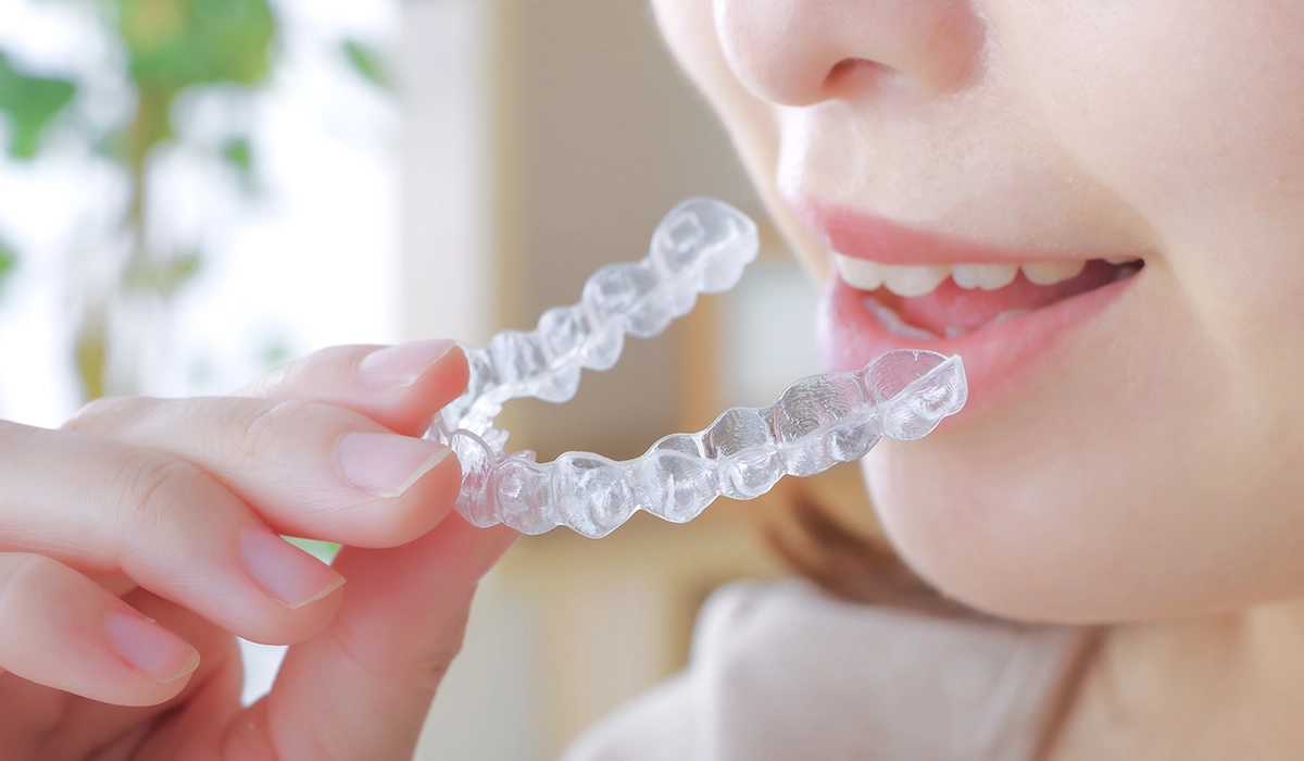 インビザライン治療の開始