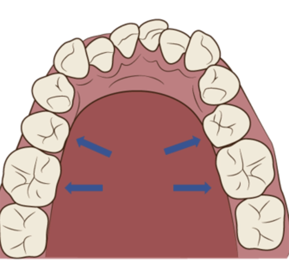 抜歯を行わない