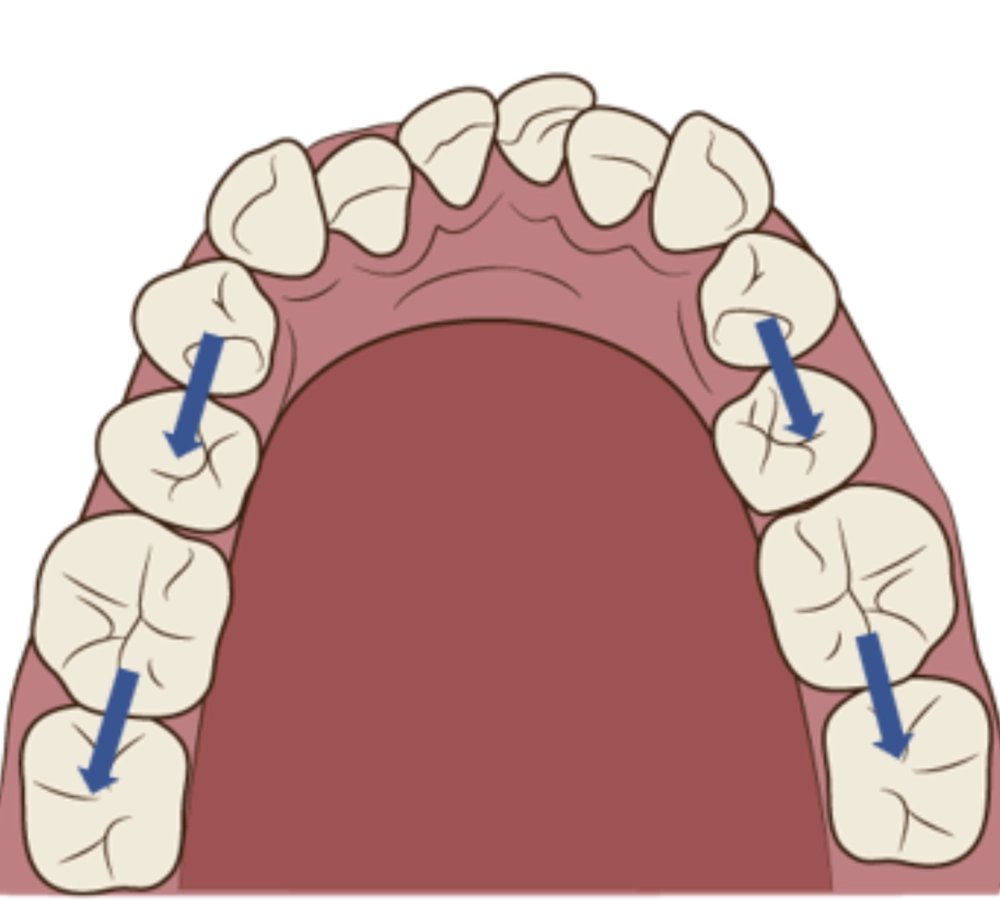 抜歯を行わない