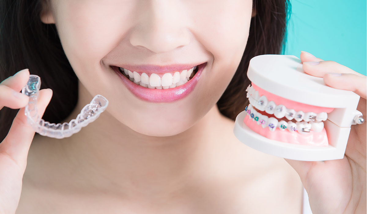 インビザライン矯正とワイヤー矯正はどちらが早い?