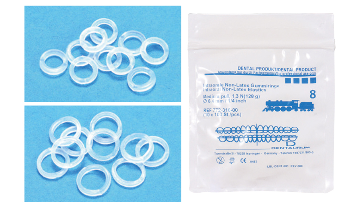 インビザラインのゴム掛けとは?