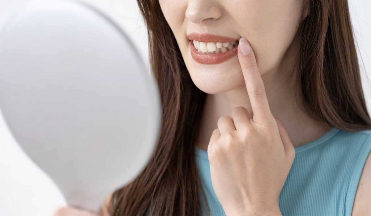 インビザラインを交換した直後に起こりうる口内のトラブル