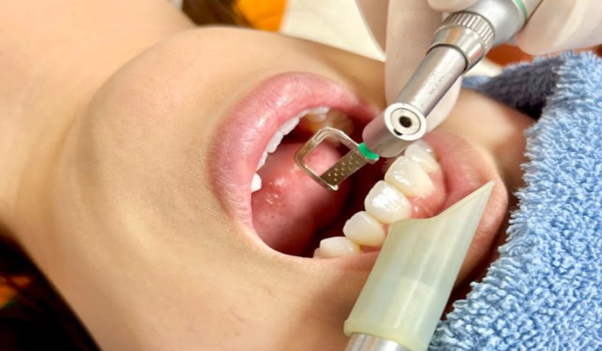 ブラックトライアングルの治療法