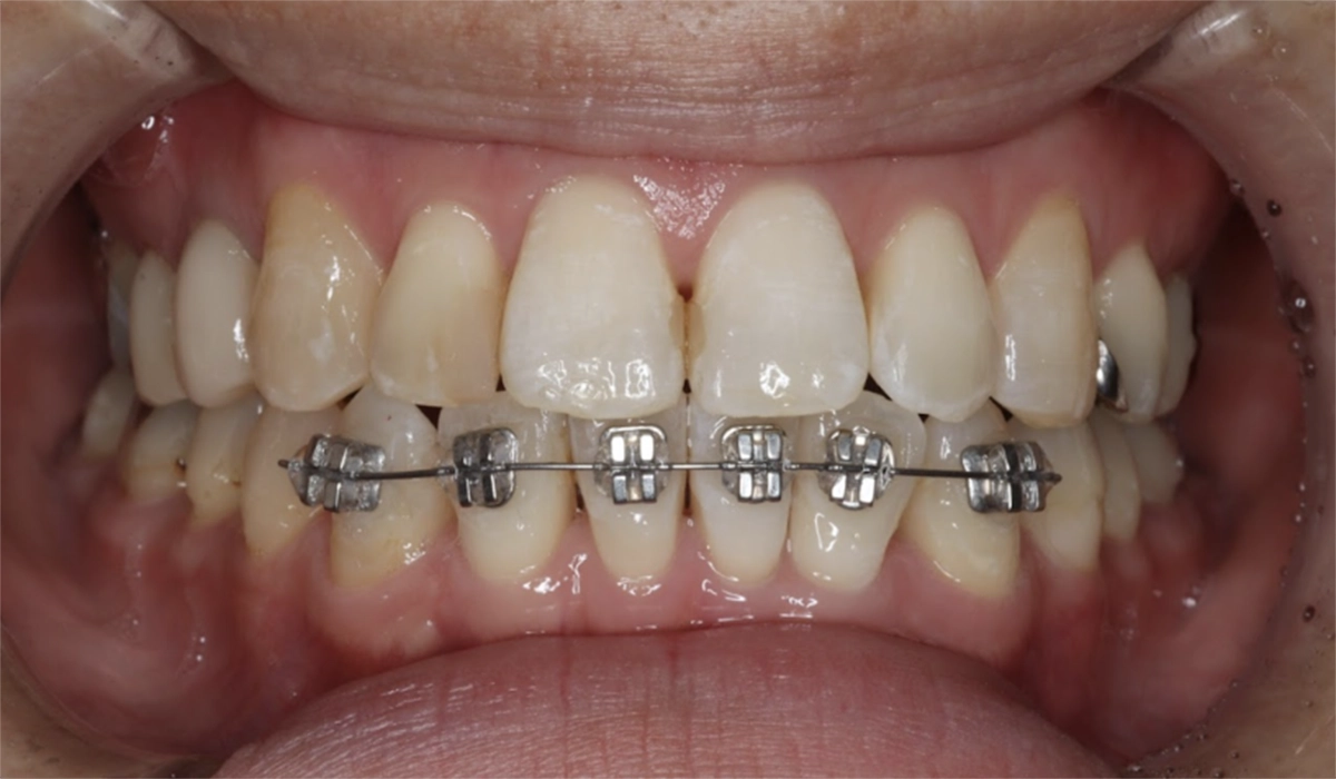 他の治療方法を検討する